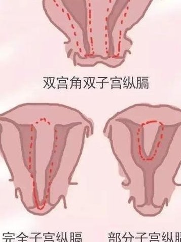 三代试管婴儿的费用是多少？附试管婴儿费用明细
